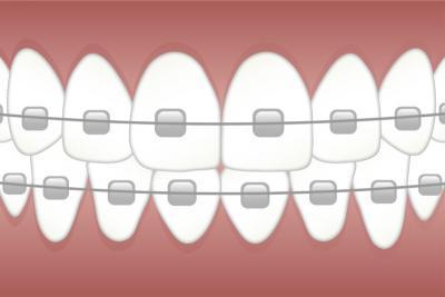 orthodontie adulte aubervilliers